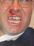 My_poor_teeth.jpg