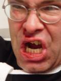 No_lip_stitches.jpg