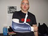 The_sling_before_the_cast.jpg